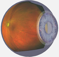 Advanced Retinal Imaging